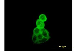 Immunofluorescence of monoclonal antibody to TUBA1B on A-431 cell. (TUBA1B anticorps  (AA 1-451))