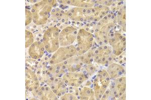 Immunohistochemistry of paraffin-embedded Mouse kidney using DAPK1 antibody at dilution of 1:100 (x400 lens). (DAP Kinase 1 anticorps)