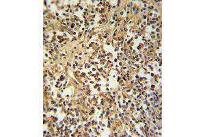 GZ Antibody (Center) (ABIN390763 and ABIN2841021) IHC analysis in formalin fixed and paraffin embedded human lymph tissue followed by peroxidase conjugation of the secondary antibody and DAB staining.