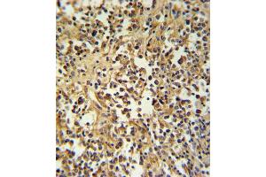 GZ Antibody (Center) (ABIN390763 and ABIN2841021) IHC analysis in formalin fixed and paraffin embedded human lymph tissue followed by peroxidase conjugation of the secondary antibody and DAB staining. (GZMM anticorps  (AA 84-113))