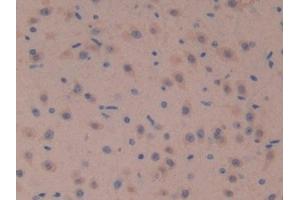 Detection of SOSTDC1 in Mouse Brain Tissue using Polyclonal Antibody to Sclerostin Domain Containing Protein 1 (SOSTDC1) (SOSTDC1 anticorps  (AA 24-206))