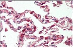 Human Lung: Formalin-Fixed, Paraffin-Embedded (FFPE)