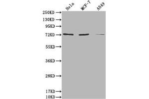 Western Blot Positive WB detected in: Hela whole cell lysate, MCF-7 whole cell lysate, A549 whole cell lysate All lanes: SAMHD1 antibody at 1:2000 Secondary Goat polyclonal to rabbit IgG at 1/50000 dilution Predicted band size: 73, 64, 69 kDa Observed band size: 73 kDa (SAMHD1 anticorps  (AA 1-314))