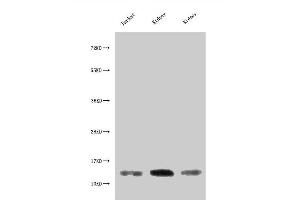 Western Blot Positive WB detected in: Jurkat whole cell lysate, Rat kidney tissue, Mouse kidney tissue All lanes: MIF antibody at 3 μg/mL Secondary Goat polyclonal to rabbit IgG at 1/50000 dilution Predicted band size: 13 kDa Observed band size: 13 kDa