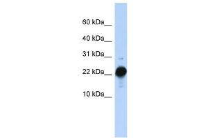CSHL1 antibody used at 1 ug/ml to detect target protein. (CSHL1 anticorps  (C-Term))