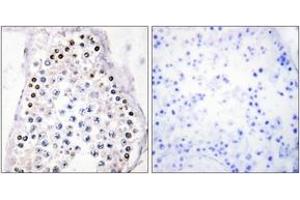 Immunohistochemistry analysis of paraffin-embedded human testis tissue, using HOXA1/B1/D1 Antibody. (HOXA1/B1/D1 anticorps  (AA 216-265))