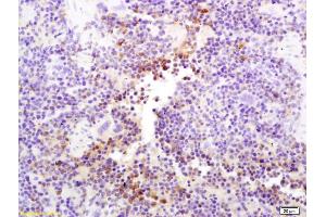 Formalin-fixed and paraffin embedded mouse spleen labeled with Anti-CD335/NKp46/NCR1 Polyclonal Antibody, Unconjugated (ABIN1386154) at 1:200 followed by conjugation to the secondary antibody and DAB staining