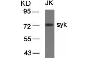 Image no. 3 for anti-Spleen tyrosine Kinase (SYK) (AA 321-325) antibody (ABIN319416) (SYK anticorps  (AA 321-325))
