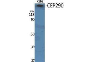 Western Blotting (WB) image for anti-Centrosomal Protein 290kDa (CEP290) (Internal Region) antibody (ABIN3174343) (CEP290 anticorps  (Internal Region))