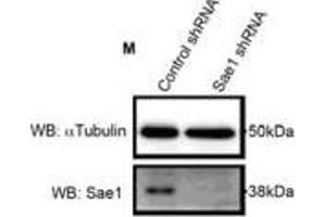Ubc9, germinal center-associated nuclear protein (GANP) and Sae1 depletion alter the distribution of reporter mRNA MHC-ftz-Δi.