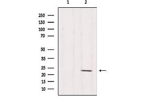 Western blot analysis of extracts from Hela, using RPS5 Antibody. (RPS5 anticorps  (Internal Region))