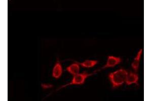 ABIN6274913 staining NIH-3T3 by IF/ICC. (GLB1 anticorps  (Internal Region))