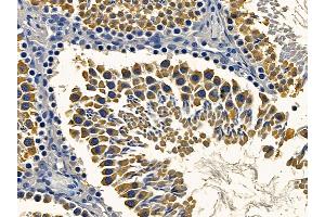 ABIN6264324 and ABIN6272396 at 1/100 staining rat testis tissue by IHC-P.