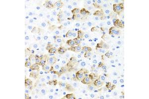 Immunohistochemistry of paraffin-embedded rat liver using F3 Antibody (ABIN5970642) at dilution of 1/100 (40x lens). (Tissue factor anticorps)