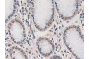 Detection of USP7 in Human Stomach Tissue using Polyclonal Antibody to Ubiquitin Specific Peptidase 7 (USP7)