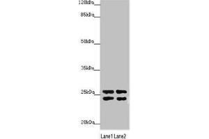 Western blot All lanes: GRPEL1 antibody at 2. (GRPEL1 anticorps  (AA 1-217))