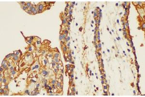 Immunohistochemistry of paraffin-embedded Human placenta using ANXA5 Ployclonal Antibody at dilution of 1:100. (Annexin V anticorps)