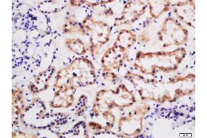 IHC-P analysis of human kidney tissue.
