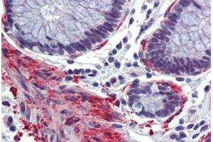 Colon, Human: Formalin-Fixed, Paraffin-Embedded (FFPE)