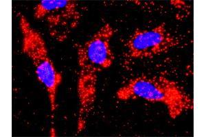 Proximity Ligation Analysis of protein-protein interactions between TP53 and PIAS1.