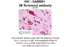 Image no. 1 for anti-gamma-aminobutyric Acid (GABA) B Receptor, 1 (GABBR1) (Extracellular Domain), (N-Term) antibody (ABIN1734543)