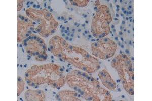 Used in DAB staining on fromalin fixed paraffin- embedded kidney tissue (ABCB6 anticorps  (AA 590-842))