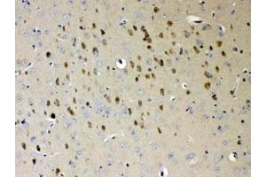 IHC testing of FFPE mouse brain tissue with NDRG3 antibody at 1ug/ml. (NDRG3 anticorps)