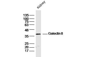 Mouse Kidney lysates probed with Galectin 8 Polyclonal Antibody, Unconjugated  at 1:300 dilution and 4˚C overnight incubation.