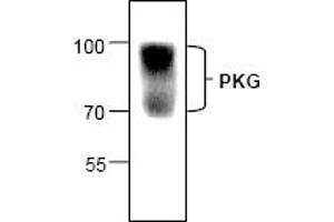 Image no. 1 for anti-Protein Kinase, CGMP-Dependent, Type I (PRKG1) (N-Term) antibody (ABIN127130) (PRKG1 anticorps  (N-Term))
