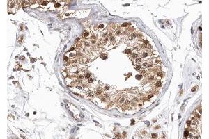 ABIN6268750 at 1/100 staining human testis tissue sections by IHC-P. (Patched 1 anticorps)