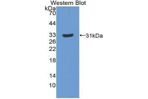 Detection of Recombinant PXN, Rat using Polyclonal Antibody to Paxillin (PXN)