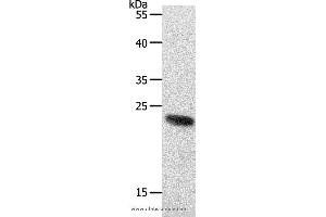 Western blot analysis of 231 cell, using RAMP2 Polyclonal Antibody at dilution of 1:650 (RAMP2 anticorps)