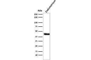 Western Blot Analysis of Endometrium muscle tissue lysate using Muscle Specific Actin Mouse Monoclonal Antibody (HHF35). (ACTA1/ACTA2A/ACTG2 anticorps)