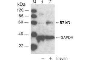 Western blot analysisLane 1: cell lysate of NIH/3T3 unstimulatedLane 2: cell lysate of NIH/3T3 stimulated with insulinPrimary Antibody: Rabbit Anti-Akt (Phospho-Ser473) Polyclonal Antibody (ABIN398632) Secondary Antibody: 0. (AKT1 anticorps  (pSer473))