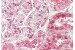 Rabbit Anti-TSC22D1 antibody Catalog Number: ARP36279 Formalin Fixed Paraffin Embedded Tissue: Human Kidney Primary antibody Concentration: 1:100 Secondary Antibody: Donkey anti-Rabbit-Cy3 Secondary Antibody Concentration: 1:200 Magnification: 20x Exposure Time: 0. (TSC22D1 anticorps  (C-Term))