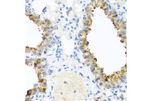 Immunohistochemistry of paraffin-embedded mouse lung using NIN antibody. (Ninein anticorps)