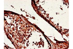 Immunohistochemistry of paraffin-embedded human testis tissue using ABIN7174080 at dilution of 1:100 (YES1 anticorps  (AA 1-155))