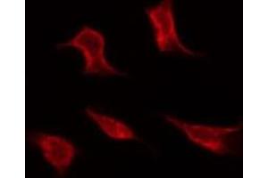 ABIN6267292 staining MDA-MB-435 by IF/ICC.
