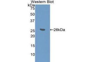 Western Blotting (WB) image for anti-BH3 Interacting Domain Death Agonist (BID) (AA 1-195) antibody (ABIN3208215) (BID anticorps  (AA 1-195))