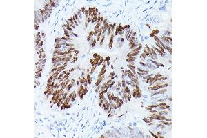 Immunohistochemistry of paraffin-embedded rat lung using GAPDH Mouse mAb (ABIN3020540, ABIN3020541, ABIN3020542 and ABIN1512934) at dilution of 1:100 (40x lens). (GAPDH anticorps)