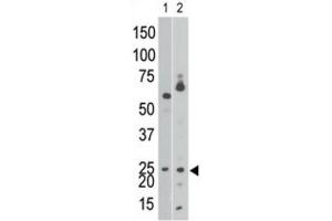 Western Blotting (WB) image for anti-BCL2/adenovirus E1B 19kDa Interacting Protein 3 (BNIP3) (BH3 Domain) antibody (ABIN2997216) (BNIP3 anticorps  (BH3 Domain))