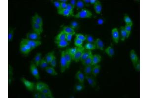 Immunofluorescence staining of HepG2 cells with ABIN7170267 at 1:133, counter-stained with DAPI. (SLC5A4 anticorps  (AA 579-633))