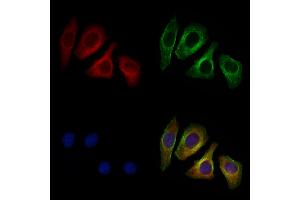 ABIN6262041 and ABIN6276973 staining Hela cells by IF/ICC. (Glypican 3 anticorps  (N-Term))