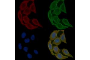 ABIN6265688 and ABIN6278646 staining Hela cells(30 min of UV treatment) by IF/ICC.