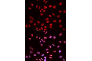 Immunofluorescence (IF) image for anti-ELK1, Member of ETS Oncogene Family (ELK1) (pSer383) antibody (ABIN1870156) (ELK1 anticorps  (pSer383))