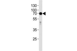 Western blot analysis of lysate from human placenta tissue lysate using anti-Alkaline Phosphatase antibody diluted at 1:1000. (Alkaline Phosphatase anticorps  (AA 274-304))