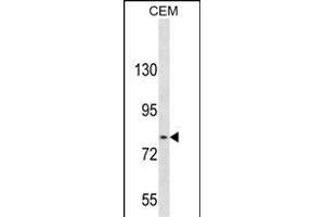 TGFBR Antibody (C-term) 3395b western blot analysis in CEM cell line lysates (35 μg/lane). (TGFBRAP1 anticorps  (C-Term))