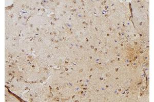 ABIN6264495 and ABIN6276345 at 1/100 staining Mouse brain tissue by IHC-P. (PSME3 anticorps  (N-Term))