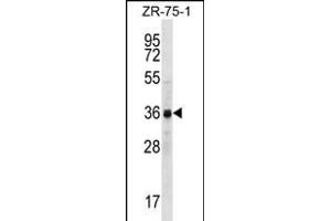 CCNYL2 Antibody (Center) (ABIN656247 and ABIN2845564) western blot analysis in ZR-75-1 cell line lysates (35 μg/lane). (CCNYL2 anticorps  (AA 162-191))