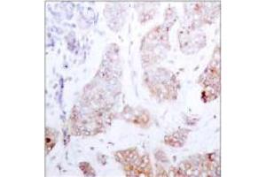 Image no. 1 for anti-V-Raf-1 Murine Leukemia Viral Oncogene Homolog 1 (RAF1) (Ser259) antibody (ABIN197102)